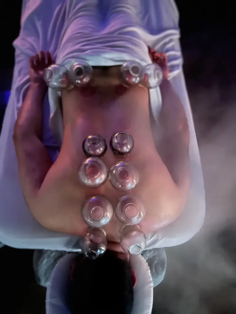 Cupping and recovery work along an athlete's back during a sports recovery session at PreBodyworks